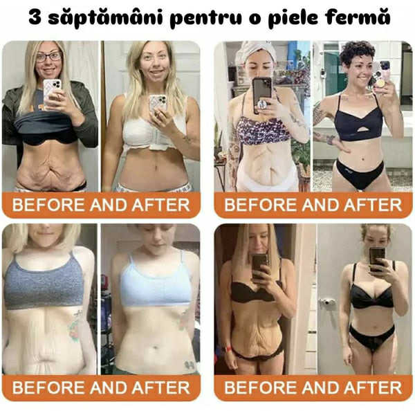 Ser Hidratant din Venin de Albine pentru Întinerirea Pielii